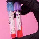 How COVID-19 is linked to diabetes