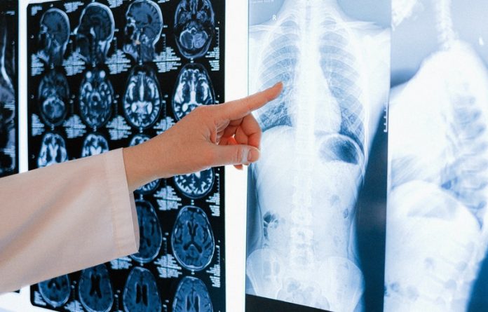Many people with COVID-19 get deadly ‘black fungus’ disease