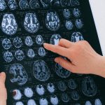 Scientists find a better way to diagnose brain cancer