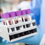 This simple blood test may achieve early detection of oral cancer