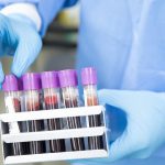 Blood test could predict future risk of blood cancer