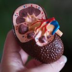 Men with chronic kidney disease may have worse outcomes than women