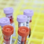 Scientists can detect Alzheimer’s disease 17 years before symptoms appear