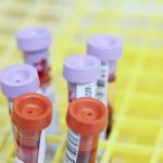 This blood test could detect very early pancreatic cancer