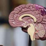 What is frontotemporal dementia?