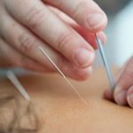 Acupuncture may help prevent type 2 diabetes