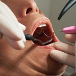 Certain bacteria in mouth linked to high blood pressure in older people