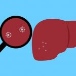 Scientists find new option for older people with liver cancer