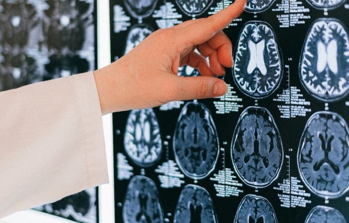 The chemical imbalance theory of depression is dead, but that doesn’t mean antidepressants don’t work