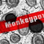What you should know about monkeypox