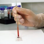 ‘Bad’ cholesterol linked to long COVID and other chronic diseases