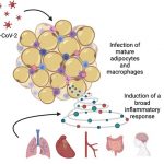 COVID-19 virus can infect fat tissue, shows Stanford study