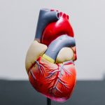 This study shows an important cause of heart disease