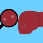 Sobering facts about wine, women and liver disease