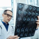 Common nutrient in diet plays a big role in preventing Alzheimer’s disease