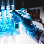 Scientists find simpler and better bladder cancer checks