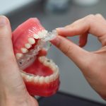 How high blood pressure affect dental treatments