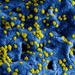 Recognizing and treating fungal infections