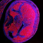 Scientists discover tiny plastics in developing chicken hearts