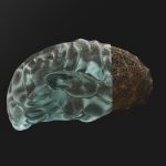 Sensory stimulation in Alzheimer’s care: What to know