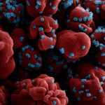 COVID-19 reinfections show similar severity to original cases, study finds