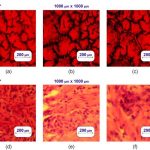 Scientists develop light-based technique for early prostate cancer detection with 90% accuracy