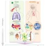 Study finds Alzheimer’s-like brain changes in long COVID patients