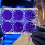 Scientists find new way to stop spread of cancer