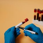 High levels of this stuff in the blood could signal early Alzheimer’s disease