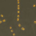 Ancient algae revived after 7,000 years in the Baltic Sea