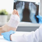 Research finds key cause of diabetic foot reinfections