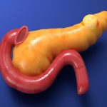 Root cause of pancreatic cancer and new treatment