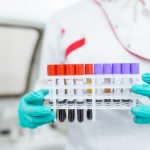 New blood test promises early detection of Alzheimer’s disease