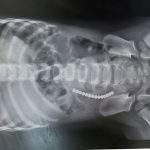 Swallowing magnets sends hundreds of children to hospital, doctors urge parents to stay alert