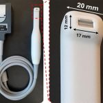 New ultrasound toothbrush could detect gum disease without the poking