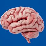 Scientists find a surprising cause of stroke