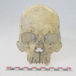 Ancient DNA reveals leprosy existed in the Americas 4,000 years ago
