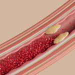 This genetic mutation combo can raise blood clot risk by 180%