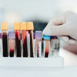 New blood test could predict heart disease more accurately