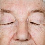 Hidden brain fluid leaks may be mistaken for dementia