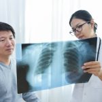 Radiation therapy improves lung cancer therapy