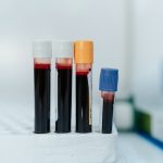 Blood test may predict risk of severe respiratory disease