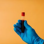 New blood test could predict heart disease risk better than cholesterol levels alone