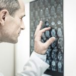 New research identifies early Alzheimer’s target that could delay symptoms
