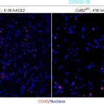 Protein CD82 may hold the secret to preventing multi-organ failure