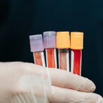 New blood test reveals how fast each part of your body is aging