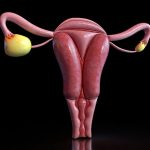 Scientists discover root cause of deadliest ovarian cancer