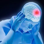 Could concussions be an early sign of ALS?
