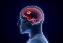 How diet could help fight deadly brain tumors