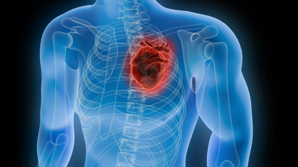 Sorry! Image not available at this time